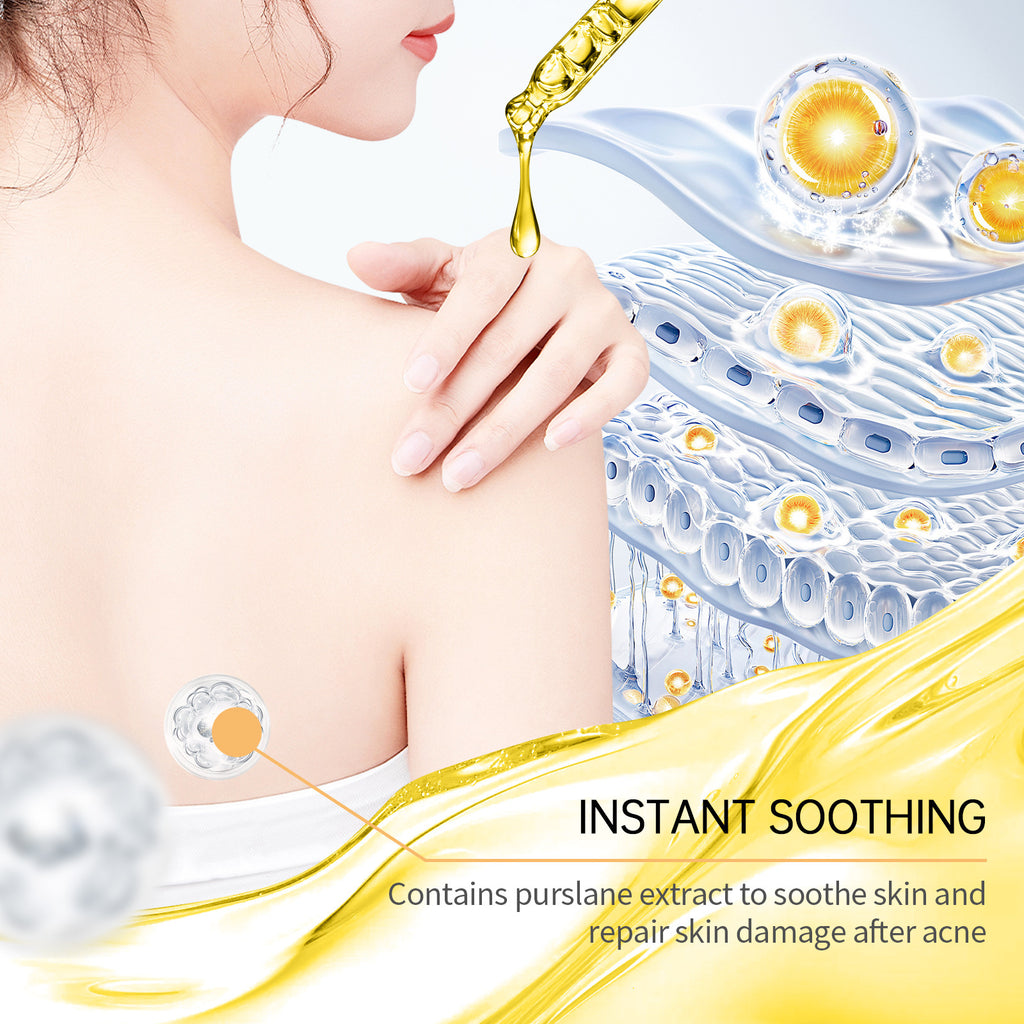 Akne-Hautpflege-Set Care Tender